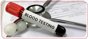 What You Need to Know About Blood Testing? | PrimeHealth Primary Care What You Need to Know About Blood Testing? | PrimeHealth Primary Care