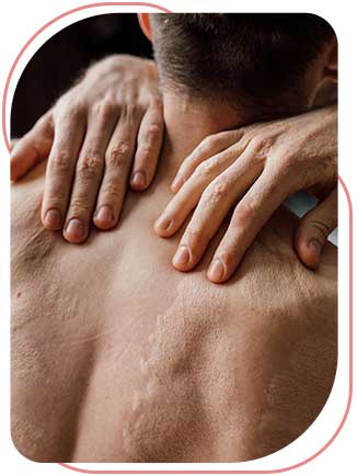 Burn Care Near Me in Bradenton, FL