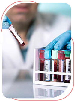 Lab Tests Near Me in Bradenton, FL