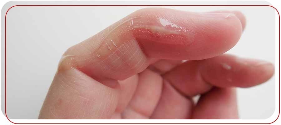 Skin Glue Application Services Near Me in Bradenton, FL Skin Glue Application Services Near Me in Bradenton, FL