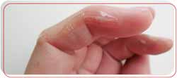 Skin Glue Application Services Near Me in Bradenton, FL Skin Glue Application Services Near Me in Bradenton, FL