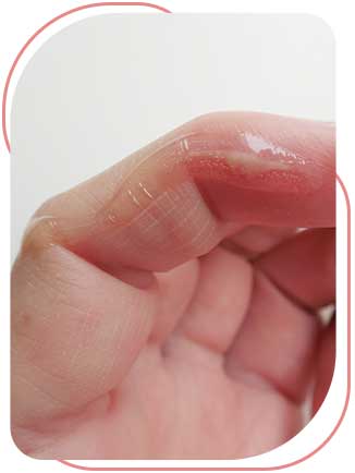 Skin Glue Application Near Me in Bradenton, FL