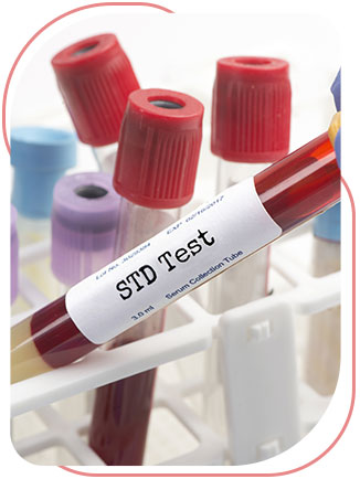 STD Testing Near Me in Bradenton, FL 