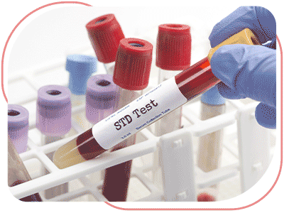 STD Test Near Me in Bradenton, FL