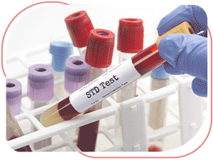 STD Test Near Me in Bradenton, FL