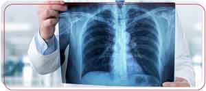 X-Ray Services Near Me in Bradenton, FL X-Ray Services Near Me in Bradenton, FL
